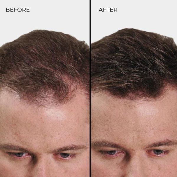 NANOGEN HAIR FIBRES - Auburn 15 gm - Image 7